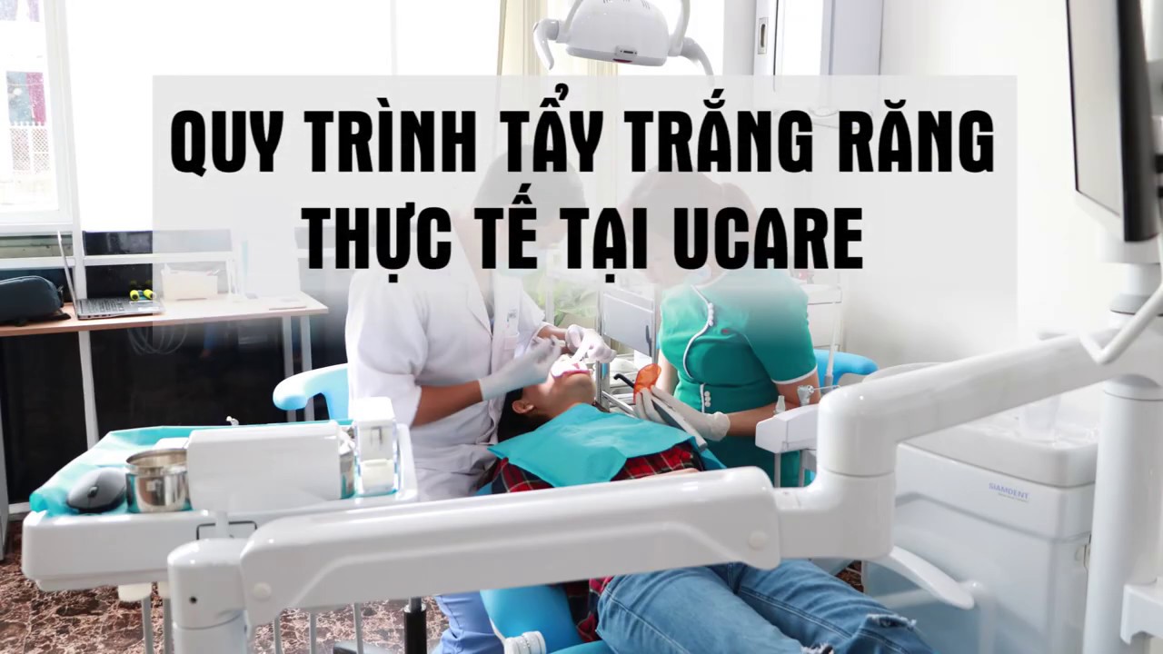 Tẩy trắng răng tại Nha Khoa Ucare